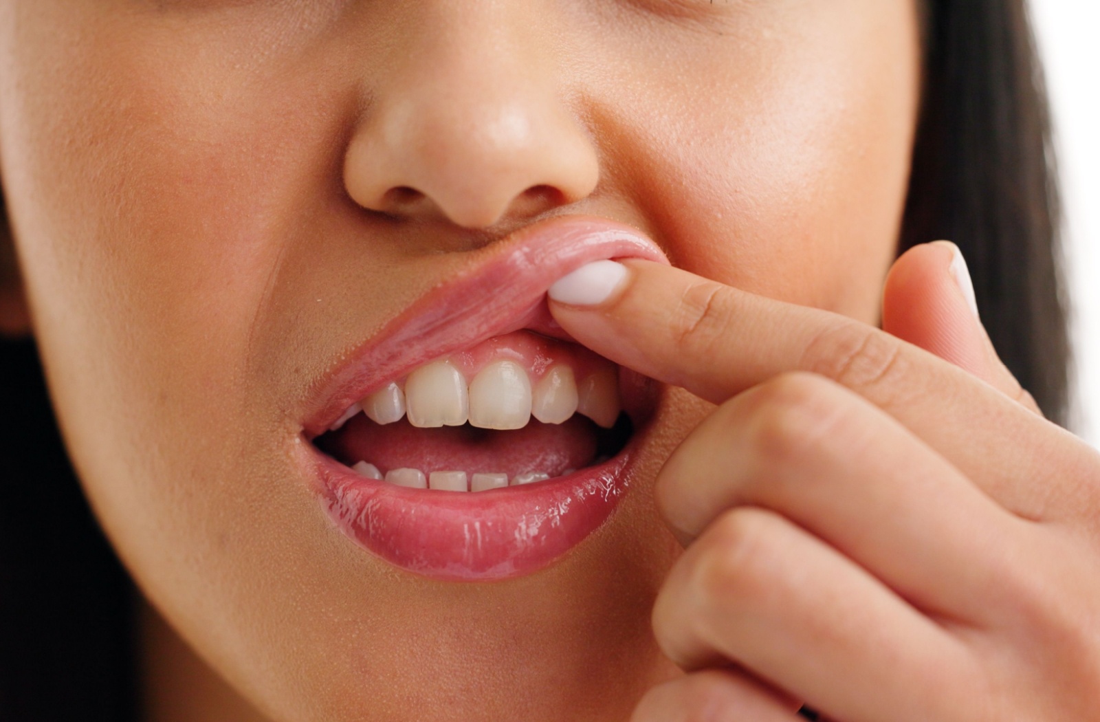 A close up of a persons gum line